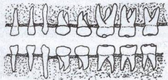 Teeth type diagram